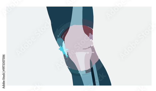 Minimal Knee Joint Osteoarthritis Blue Neon Medical Vector Illustration