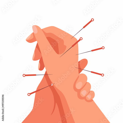An artistic portrayal of acupuncture treatment focusing on hands, with needles shown delicately placed, highlighting therapeutic practices and self-care in wellness and health.