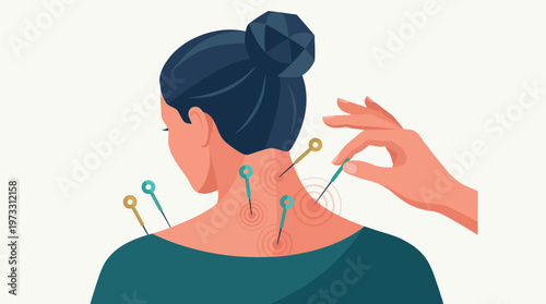 This illustration depicts a woman receiving acupuncture treatment on the neck, showcasing the soothing practice of alternative medicine for pain relief and relaxation.