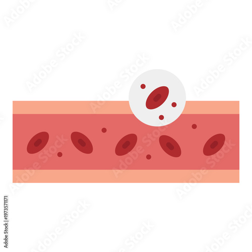 Blood Clot Illustration in Vein
