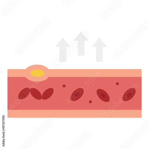 Pimple Illustration: Skin Inflammation and Acne Treatment Concept