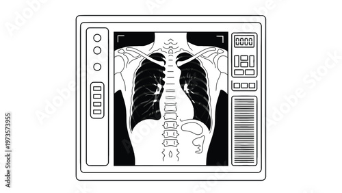 Detailed Black and White Line Art Illustration of Human Chest X-Ray Scan on Medical Monitor, Highlighting Lungs, Ribs, Heart, and Spine.