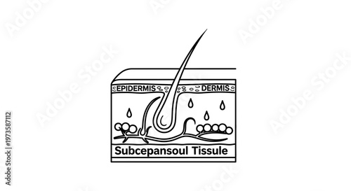 Cross-section of human skin layers: epidermis, dermis, and subcutaneous tissue with hair follicle and sweat glands