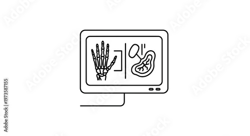 Digital X-ray of Hand and Organ on Monitor Screen, Medical Imaging Technology