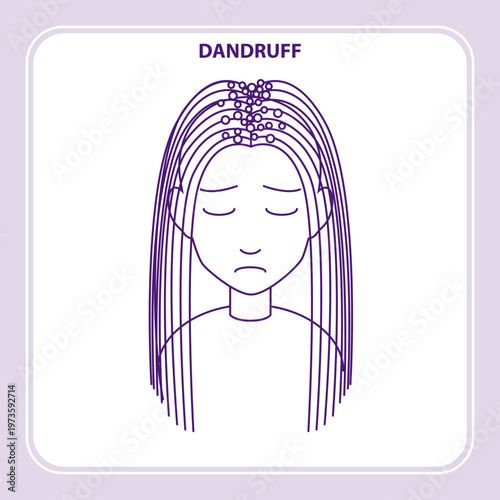 Dandruff Hair Vector Outline Icon