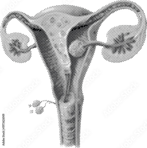 Halftone illustration of human female reproductive system organ anatomy uterus ovaries fallopian tubes  illustration