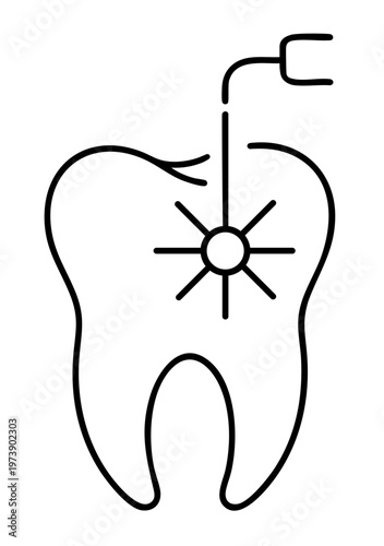 Dental Laser Treatment on Tooth Surface, Modern Caries Removal and Sterilization Procedure