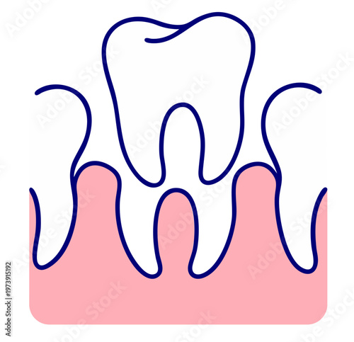 Gum Recession Tooth Condition, Exposed Roots Due to Gum Loss, Periodontal Disease Dental Problem