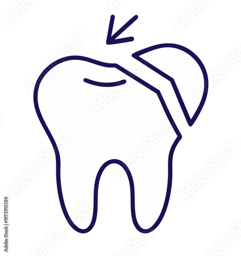 Broken tooth with chipped crown — severe damage of enamel requiring restoration or crown treatment