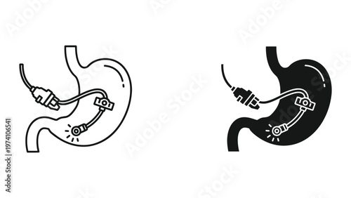 Endoscopy Stomach Medical Procedure Diagnostic Health