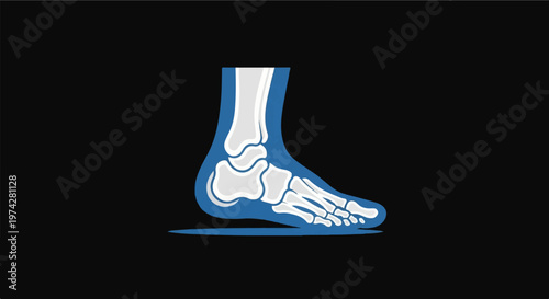 Stylized illustration of a human foot skeleton within a blue outline, against a black background
