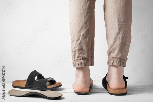 Rear view of legs with valgus foot using orthopedic insole and corrective slippers
