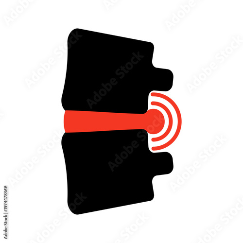 Spine with disc inflammation black icon. Human vertebrae showing injury, nerve pain. Orthopedic medical symbol backache, spinal problem, treatment, healthcare diagnostic clinic. Vector illustration