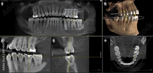 Dental cone beam computed tomography scan showing tooth analysis