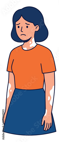 Cartoon illustration of a sad woman depicting vitiligo skin condition depicting depigmentation patches for health and awareness design