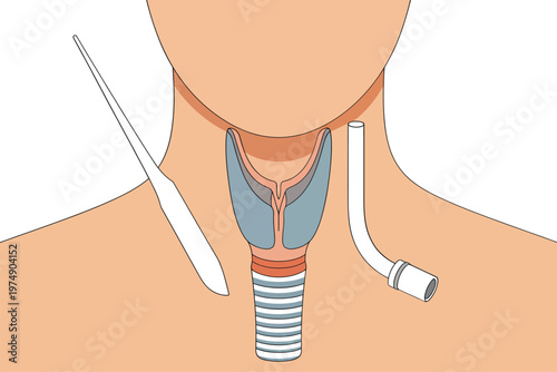 Anatomical illustration depicting a human trachea thyroid gland and medical intubation procedures high quality professional detailed