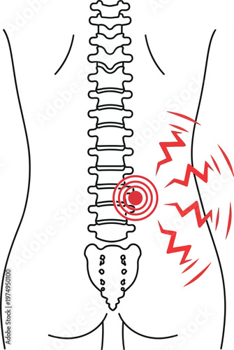 Back pain illustration with red target on spine and lightning bolt on side