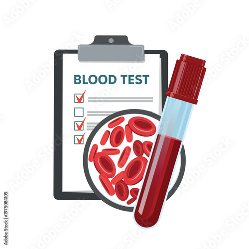 Blood Test Laboratory Report vector illustration. Blood test result on clipboard with checkmark and test tube, representing medical diagnostics, laboratory analysis, and healthcare screening.