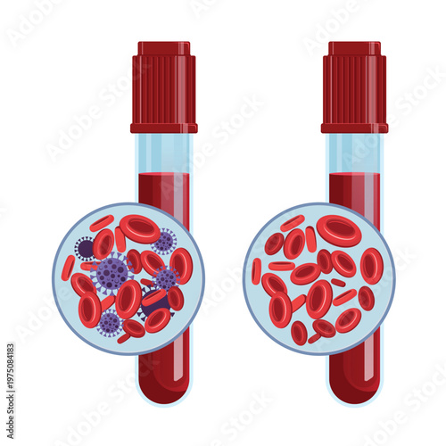 Healthy and Infected Blood Cells Comparison with Virus Illustration. Healthy and infected blood samples with red blood cells and viruses, concept of infection, diagnostics, and laboratory analysis.