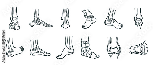 Detailed anatomical illustrations of the human foot and ankle, showcasing bones, ligaments, and joint structures from various perspectives.