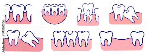 healthy teeth alignment, crowded teeth overlap, diastema gap between teeth, partially impacted wisdom tooth, horizontal impacted tooth, tooth decay and broken crown, missing tooth gap in dental row
