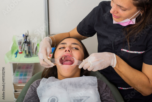 фотографія Dentist placing a cheek retractor in the patient's mouth