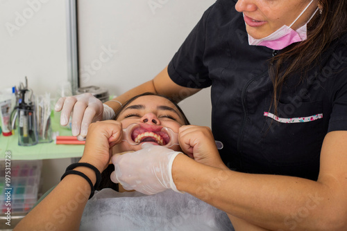 Принти на полотні Dentist placing a cheek retractor in the patient's mouth