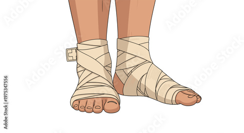 Close up of a person feet wrapped in medical elastic bandages for injury support, sprain recovery, or sports therapy.