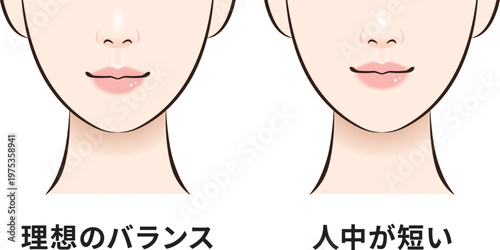理想のバランスと人中短め　顔バランス比較図（クローズアップ）