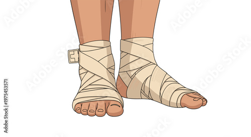 Close up view of a persons feet shows both ankles and feet wrapped in supportive tan medical bandages or athletic tape.
