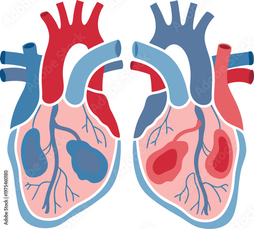Anatomical illustration depicting a healthy and diseased human heart