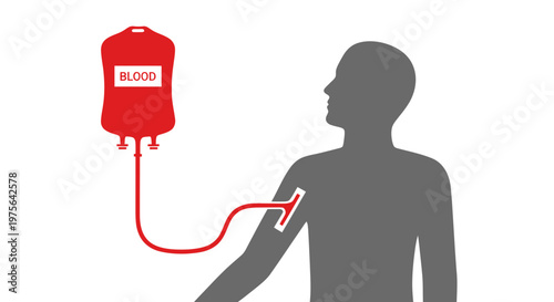 Blood transfusion process with iv bag and human silhouette receiving red liquid