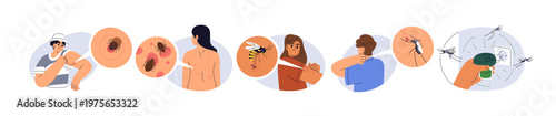 Insect bites set. People with allergy, itchy skin, rash, red marks, spots from mite, bed bug, wasp, mosquito. Scratching redness, ticks, itch. Flat vector illustrations isolated on white background