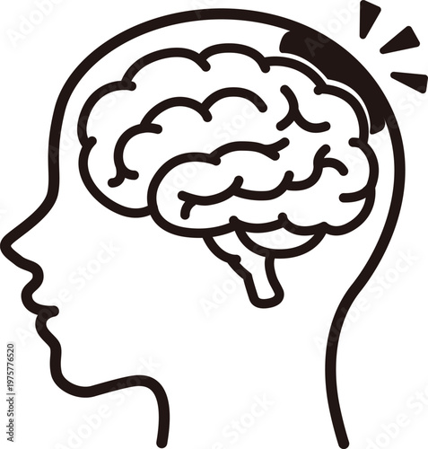 Subarachnoid hemorrhage brain stroke icon medical illustration