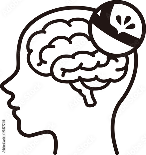 Brain hemorrhage intracerebral hemorrhage icon medical illustration