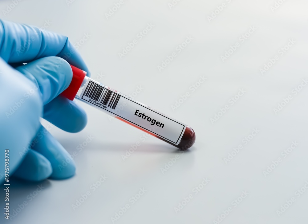 Fototapeta premium Blood sample tube for estrogen test analysis.
