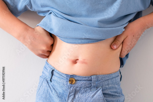 Child lifts his shirt to reveal his stomach and shows an iron burn near his belly button, experiencing pain and discomfort that requires medical attention