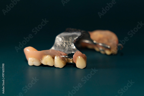 Removable partial denture with artificial teeth and metal base on dark green background. Studio macro photography isolated object. Dentistry and oral healthcare concept. Design for poster, banner.