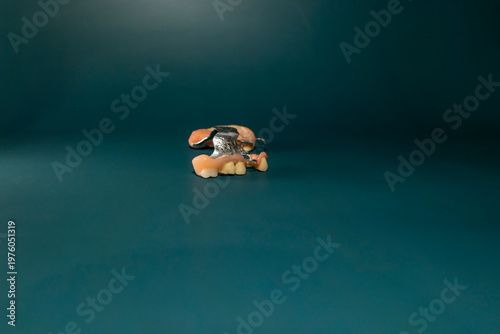 Removable partial denture with artificial teeth and metal base on dark green background. Studio macro photography isolated object. Dentistry and oral healthcare concept. Design for poster, banner.