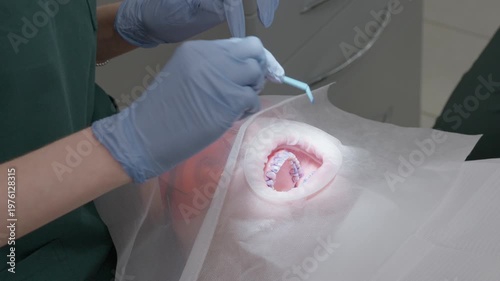 Specialist using blue liquid indicator for plaque detection and hygiene assessment. Professional dental checkup for identifying areas with high bacterial concentration in oral cavity