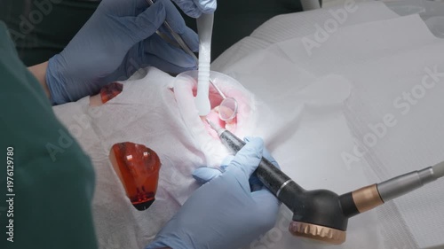 Dentist uses professional air flow sandblasting device for deep teeth cleaning and plaque removal. Dental hygienist performing prophylactic treatment for patient oral hygiene care service.