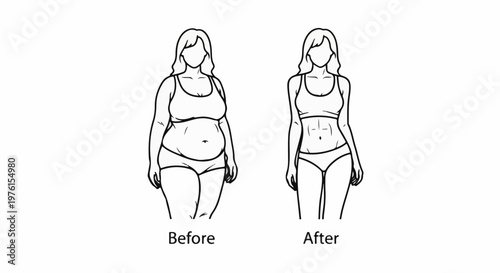 Hand-drawn line art shows a comparison of female body shapes, before and after