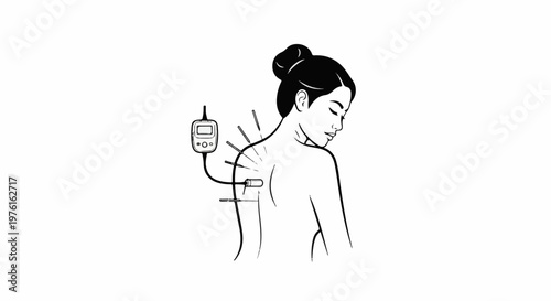 Woman receiving electro-acupuncture treatment for pain relief and wellness