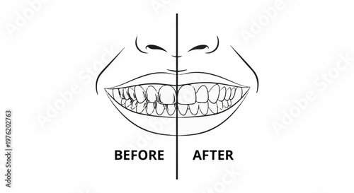 A split image shows a mouth, half illustrating teeth before dental work, half after