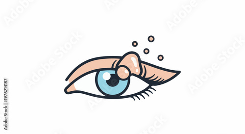 Stylized illustration of a human eye with a stye on the eyelid