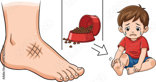 Child Foot Injury Vector Illustration with Wound on Foot and Pain from Sharp Object Accident Medical Concept Isolated on Background
