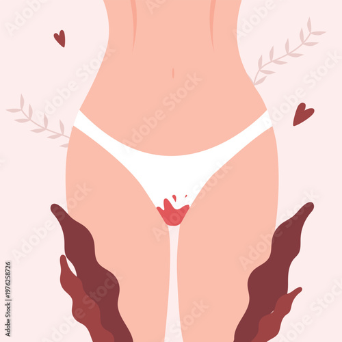 The concept of the menstrual period. Women's thighs in bloody panties. Women's hygiene. Protection from menstruation. vector illustration