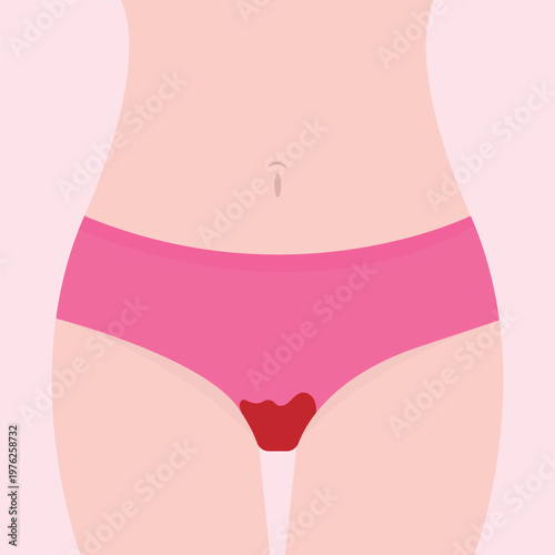 The concept of the menstrual period. Women's thighs in bloody panties. Women's hygiene. Protection from menstruation. vector illustration