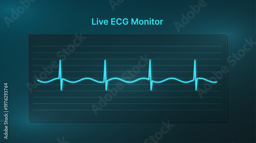 Live ECG Monitor Screen with Heartbeat Waveform. Glowing live ECG monitor illustration with a heartbeat waveform on a dark medical interface, ideal for healthcare technology. Vector HUD