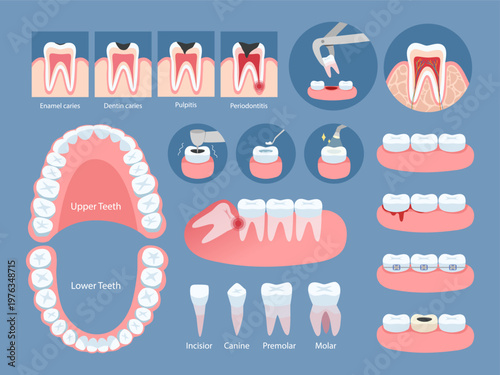 Infographics for dentistry. Illustration shows dental care stages and tooth types. Dental problems and treatment